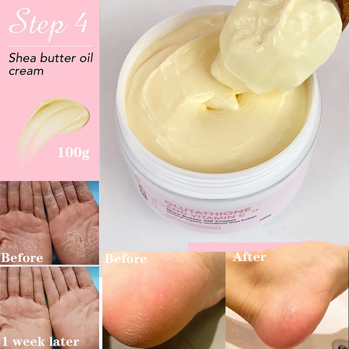 AILKE Whitening Lightening Cream Face Body Shea Butter Hydrating Moisturizer